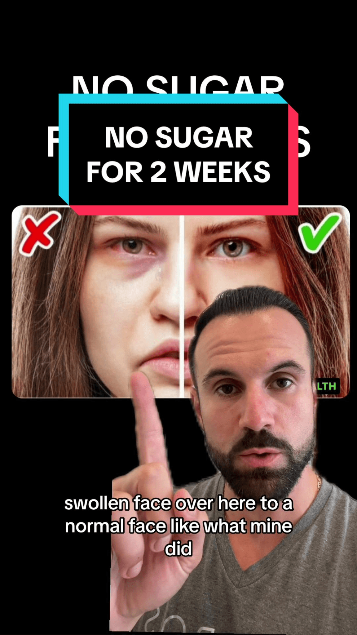 Thumbnail for Sugar-Free for 2 Weeks: Debunking the Claims